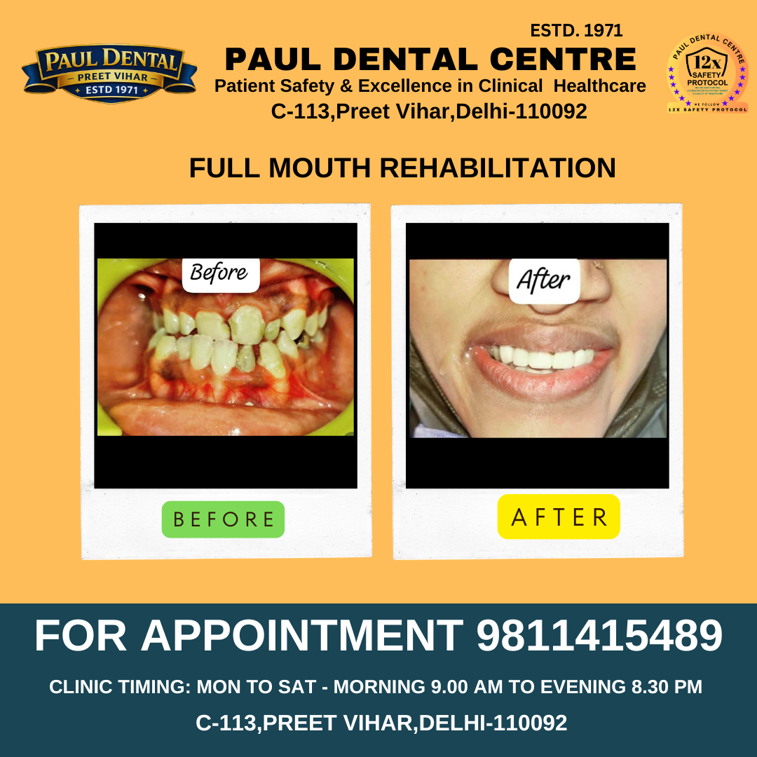 Case 30 – Paul Dental Center